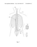 IMPLANT CURRENT CONTROLLED BATTERY CHARGING BASED ON TEMPERATURE diagram and image