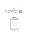 MEDICAL IMAGE DISPLAY APPARATUS, METHOD AND PROGRAM diagram and image