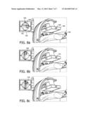 ORIENTATION REFERENCE SYSTEM FOR MEDICAL IMAGING diagram and image