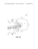 CERAMIC AND REFRACTORY METAL CORE ASSEMBLY diagram and image