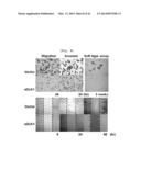Activin Receptor Type II B Inhibitors Comprising DLK1 Extracellular     Water-Soluble Domain diagram and image