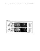 FACTOR XII INHIBITORS FOR THE TREATMENT OF SILENT BRAIN ISCHEMIA AND     ISCHEMIA OF OTHER ORGANS diagram and image