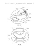 INTRA-ORAL LIGHT THERAPY APPARATUSES AND METHODS FOR THEIR USE diagram and image