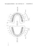 ARTIFICIAL TEETH diagram and image