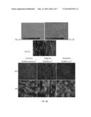 FIBER SCAFFOLDS FOR USE IN ESOPHAGEAL PROSTHESES diagram and image