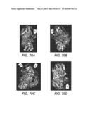 CELLULASE COMPOSITIONS AND METHODS OF USING THE SAME FOR IMPROVED     CONVERSION OF LIGNOCELLULOSIC BIOMASS INTO FERMENTABLE SUGARS diagram and image