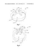 Exercise Device Control Ring diagram and image