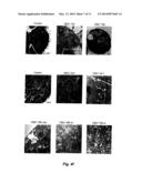 Treatment of Solid Tumours diagram and image