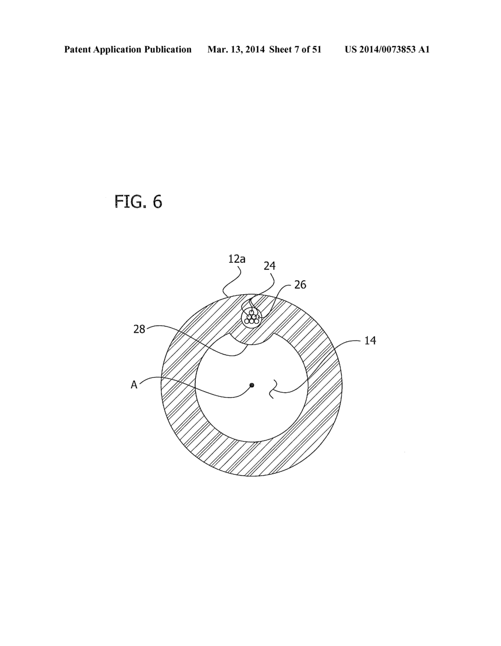 Catheter With Imaging Assembly With Placement Aid And Related Methods     Therefor - diagram, schematic, and image 08