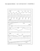 METHODS AND SYSTEMS FOR DETERMINING NOISE INFORMATION FROM A PHYSIOLOGICAL     SIGNAL diagram and image