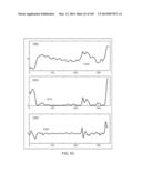 METHODS AND SYSTEMS FOR DETERMINING AN ALGORITHM SETTING BASED ON A     DIFFERENCE SIGNAL diagram and image