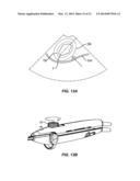 METHODS AND SYSTEMS FOR CONTROLLED DEPLOYMENT OF NEEDLE STRUCTURES IN     TISSUE diagram and image