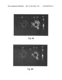 SYSTEMS AND METHODS FOR MAKING AND USING ROTATIONAL TRANSDUCERS FOR     CONCURRENTLY IMAGING BLOOD FLOW AND TISSUE diagram and image