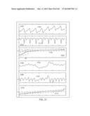 METHODS AND SYSTEMS FOR DETERMINING NOISE INFORMATION FROM A PHYSIOLOGICAL     SIGNAL diagram and image