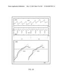 METHODS AND SYSTEMS FOR DETERMINING NOISE INFORMATION FROM A PHYSIOLOGICAL     SIGNAL diagram and image