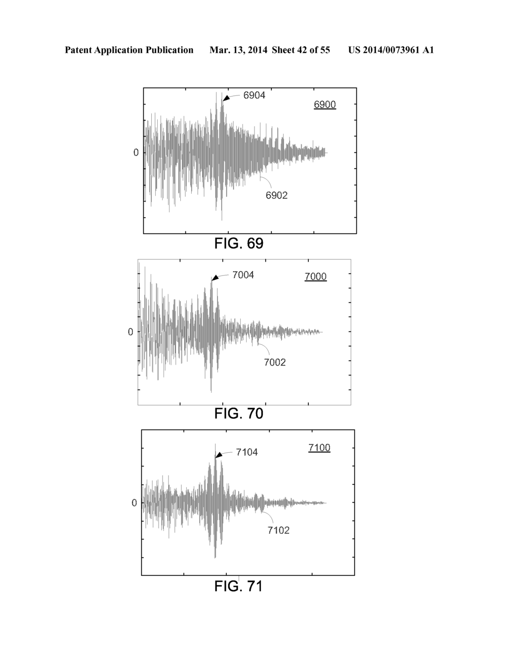 METHODS AND SYSTEMS FOR QUALIFYING PHYSIOLOGICAL VALUES BASED ON SYMMETRY     ASSOCIATED WITH A CROSS-CORRELATION SEQUENCE - diagram, schematic, and image 43