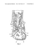 METHODS AND SYSTEMS FOR TREATING ACUTE HEART FAILURE BY NEUROMODULATION diagram and image