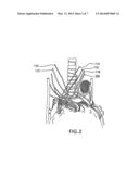 METHODS AND SYSTEMS FOR TREATING ACUTE HEART FAILURE BY NEUROMODULATION diagram and image