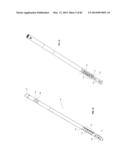 STRAIGHT INTRAMEDULLARY FRACTURE FIXATION DEVICES AND METHODS diagram and image