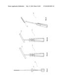 STRAIGHT INTRAMEDULLARY FRACTURE FIXATION DEVICES AND METHODS diagram and image