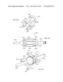 STRAIGHT INTRAMEDULLARY FRACTURE FIXATION DEVICES AND METHODS diagram and image