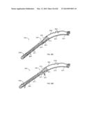 STRAIGHT INTRAMEDULLARY FRACTURE FIXATION DEVICES AND METHODS diagram and image