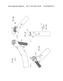 STRAIGHT INTRAMEDULLARY FRACTURE FIXATION DEVICES AND METHODS diagram and image