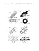 STRAIGHT INTRAMEDULLARY FRACTURE FIXATION DEVICES AND METHODS diagram and image