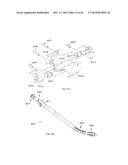 STRAIGHT INTRAMEDULLARY FRACTURE FIXATION DEVICES AND METHODS diagram and image