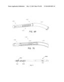 STRAIGHT INTRAMEDULLARY FRACTURE FIXATION DEVICES AND METHODS diagram and image