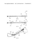 STRAIGHT INTRAMEDULLARY FRACTURE FIXATION DEVICES AND METHODS diagram and image