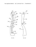 STRAIGHT INTRAMEDULLARY FRACTURE FIXATION DEVICES AND METHODS diagram and image