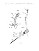 STRAIGHT INTRAMEDULLARY FRACTURE FIXATION DEVICES AND METHODS diagram and image