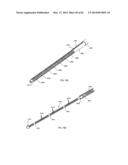 STRAIGHT INTRAMEDULLARY FRACTURE FIXATION DEVICES AND METHODS diagram and image