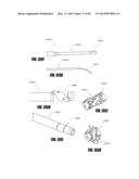 STRAIGHT INTRAMEDULLARY FRACTURE FIXATION DEVICES AND METHODS diagram and image