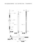 STRAIGHT INTRAMEDULLARY FRACTURE FIXATION DEVICES AND METHODS diagram and image