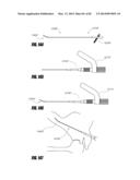 STRAIGHT INTRAMEDULLARY FRACTURE FIXATION DEVICES AND METHODS diagram and image