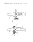 NAVIGATION INSTRUMENTS FOR SUBCHONDRAL BONE TREATMENT diagram and image