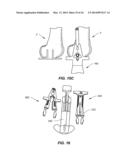 NAVIGATION INSTRUMENTS FOR SUBCHONDRAL BONE TREATMENT diagram and image