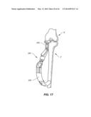 NAVIGATION INSTRUMENTS FOR SUBCHONDRAL BONE TREATMENT diagram and image