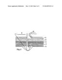 Vertical Stitcher and Suturing Method diagram and image