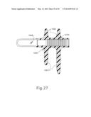 INFLATOR FOR DILATION OF ANATOMICAL PASSAGEWAY diagram and image