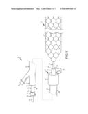 RETRIEVAL CATHETER WITH EXPANDABLE TIP diagram and image