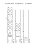 RETRIEVAL CATHETER WITH EXPANDABLE TIP diagram and image