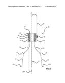 VENA CAVA FILTER WITH DUAL RETRIEVAL diagram and image