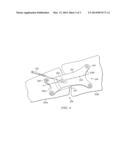 BONE PLATE WITH A TRANSFIXATION SCREW HOLE diagram and image