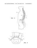 COUPLED MONOPOLAR AND MULTIPOLAR PULSING FOR CONDITIONING AND STIMULATION diagram and image