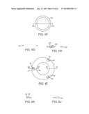 ANCHORING APPARATUS AND METHODS FOR USE diagram and image