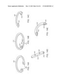 ANCHORING APPARATUS AND METHODS FOR USE diagram and image