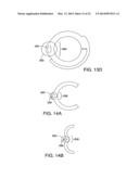 CUFF ELECTRODE HAVING TUBULAR BODY WITH CONTROLLED CLOSING FORCE diagram and image